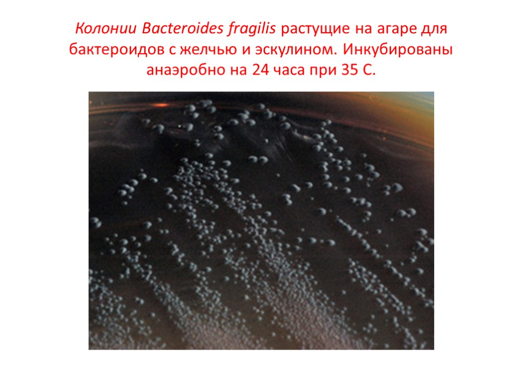 Колонии Bacteroides fragilis растущие на агаре для бактероидов с желчью и эскулином. Инкубированы анаэробно